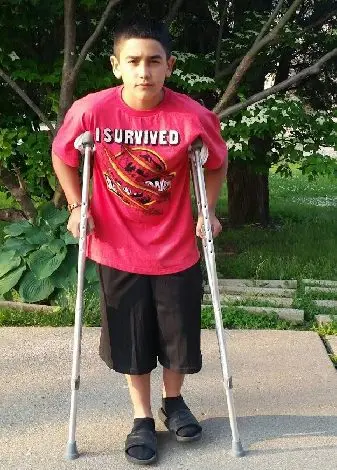 Local boy left injured following intentional hit-and-run