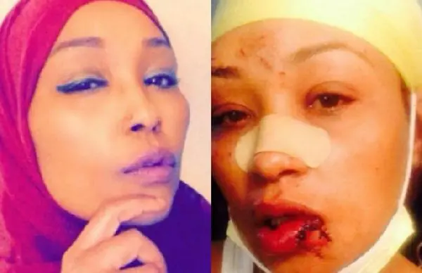 Muslim woman attacked by customer at Minnesota Applebee's