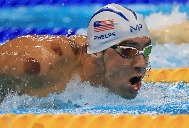 Michael Phelps' purple circles spotlight 'cupping' trend