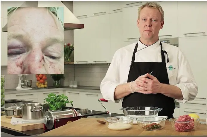 Chef says he was beaten by Muslim men because he ‘looks like Trump’