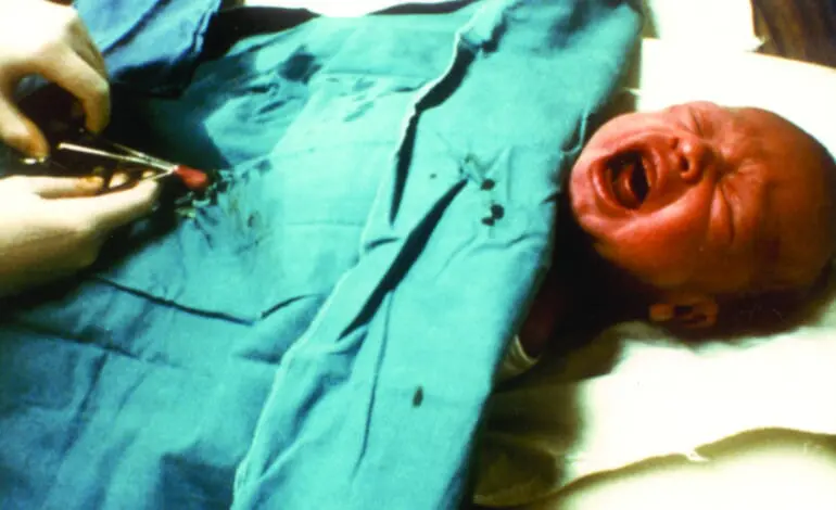 Male circumcision: Outdated tradition or necessary medical procedure?