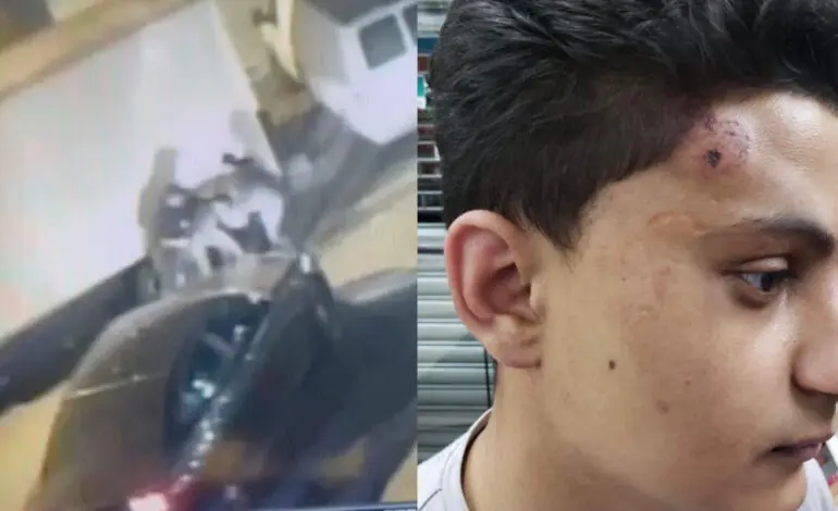 Cops under investigation for brutal attack on NJ Arab American teen