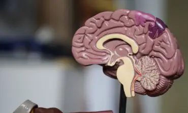 Beaumont researchers perform breakthrough study for early prediction of Alzheimer's