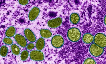 The pox on our house