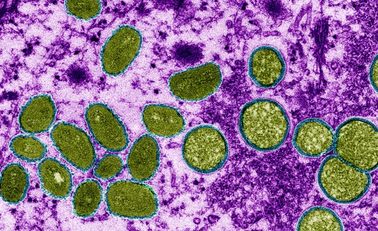 The pox on our house