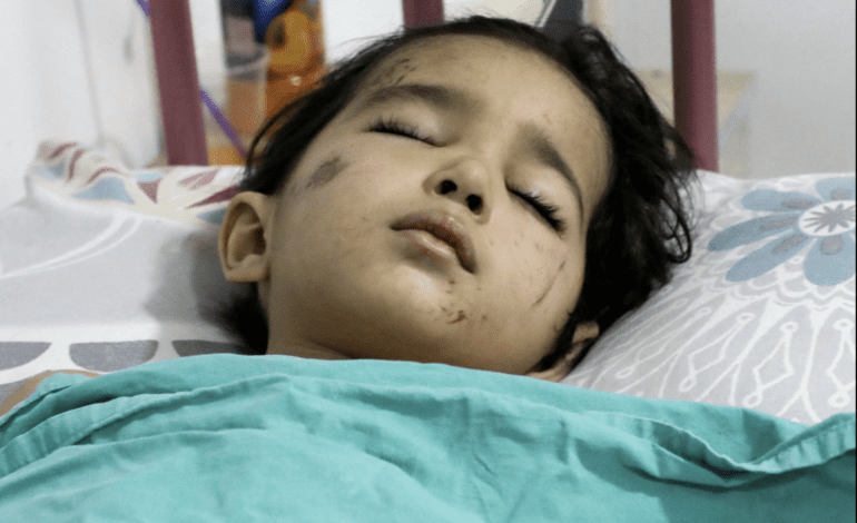 In Syria a child is saved, but loses his family