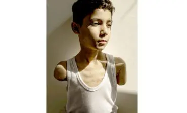 Portrait of Palestinian boy who lost both arms is World Press Photo of the Year