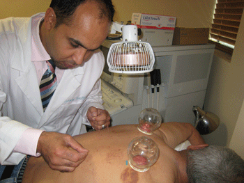 Acupuncture is a safe alternative therapy