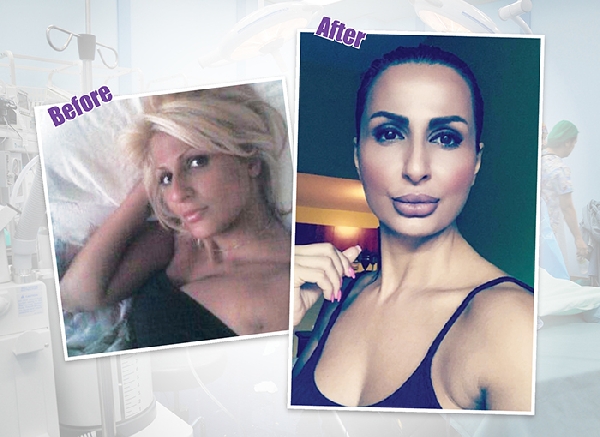 Arab Americans lead a cosmetic surgery craze
