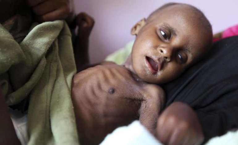 Yemen death toll could hit 233,000 by 2020