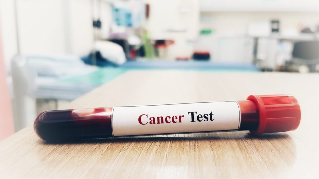 Henry Ford Health first in the state to offer new cancer-detecting ...