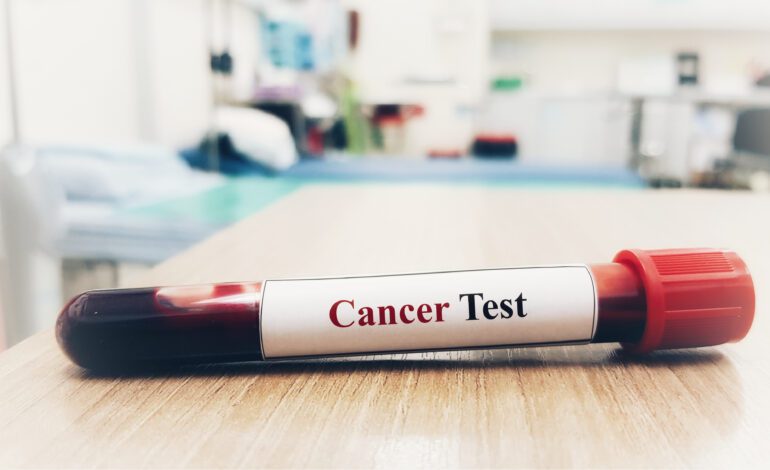 Henry Ford Health first in the state to offer new cancer-detecting blood test