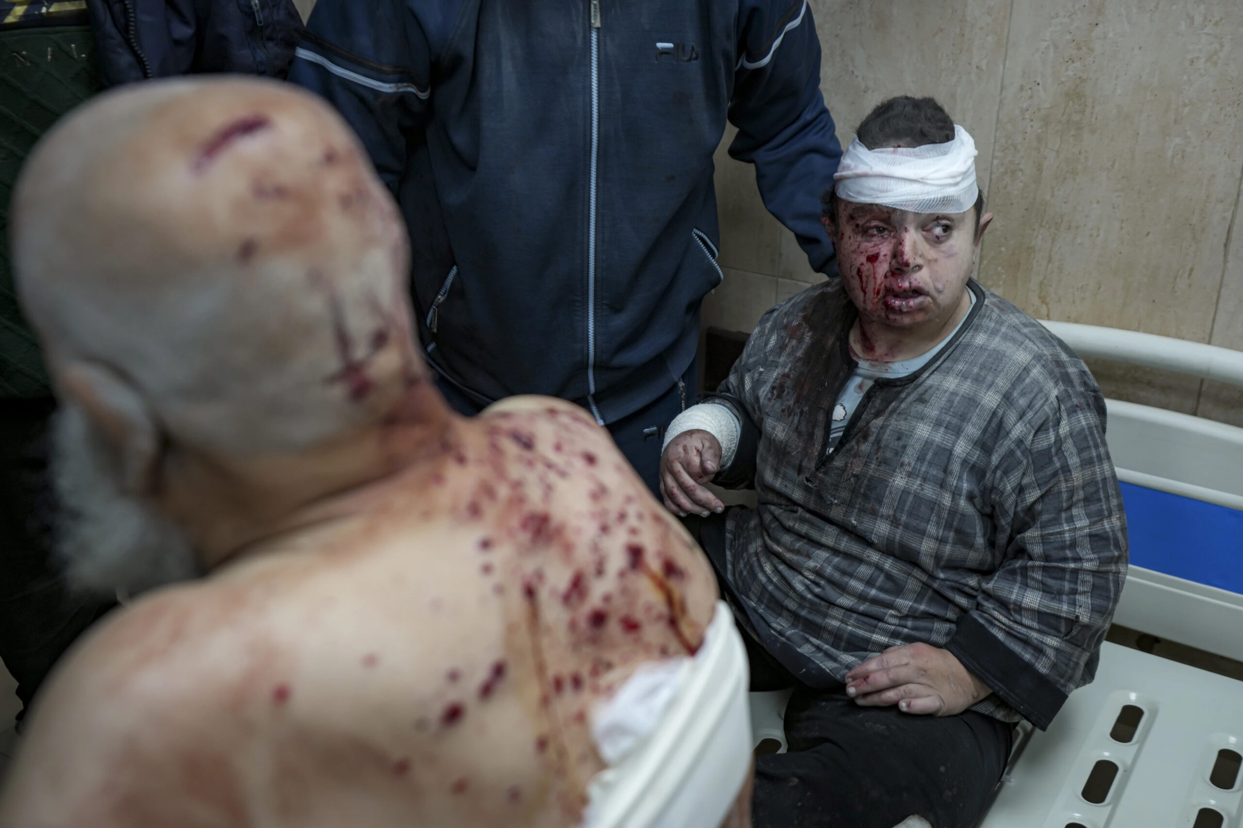 Palestinians, wounded in the Israeli bombardment of the Gaza Strip, at the Al-Aqsa Hospital in Deir al-Balah, Monday, December 16. – Photo by AP